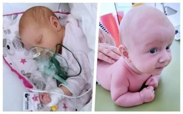 Dlaczego lek na SMA jest tak drogi? Oto powody, które zaskakują