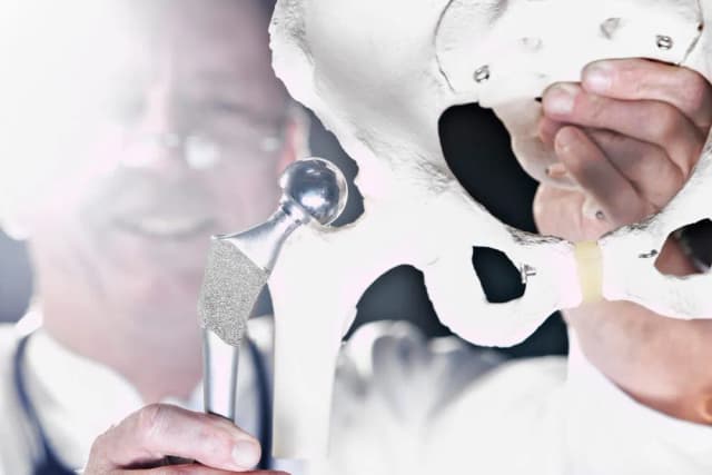 Gdzie najlepiej na endoprotezę stawu biodrowego NFZ? Sprawdź szpitale