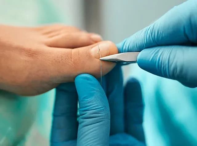 Czy podolog jest na NFZ w Krakowie? Sprawdź, co możesz zyskać