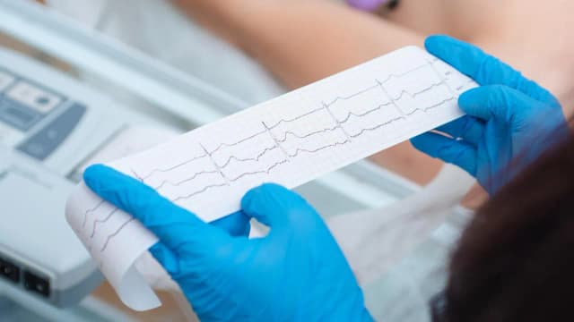 Czy lekarz rodzinny może zlecić holter? Sprawdź, co musisz wiedzieć